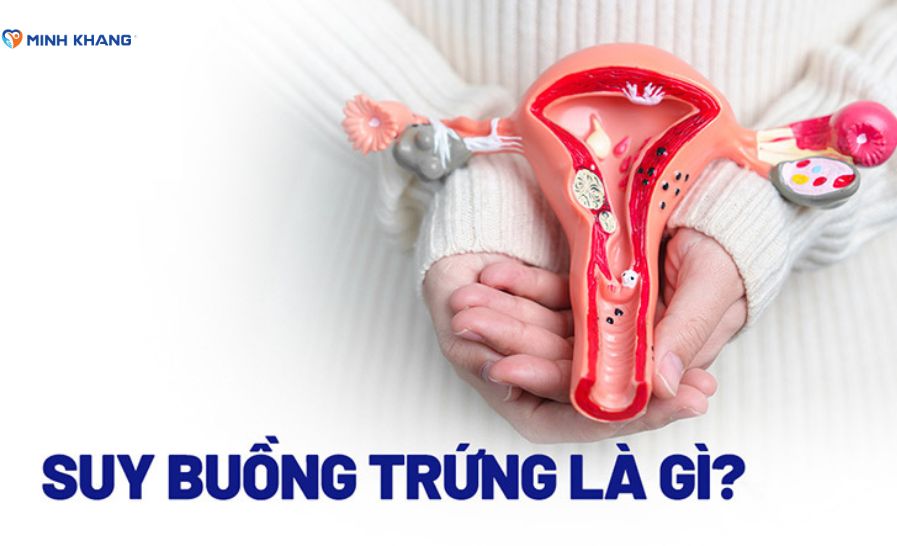 Suy buồng trứng là gì? Nguyên nhân, chẩn đoán và phòng tránh