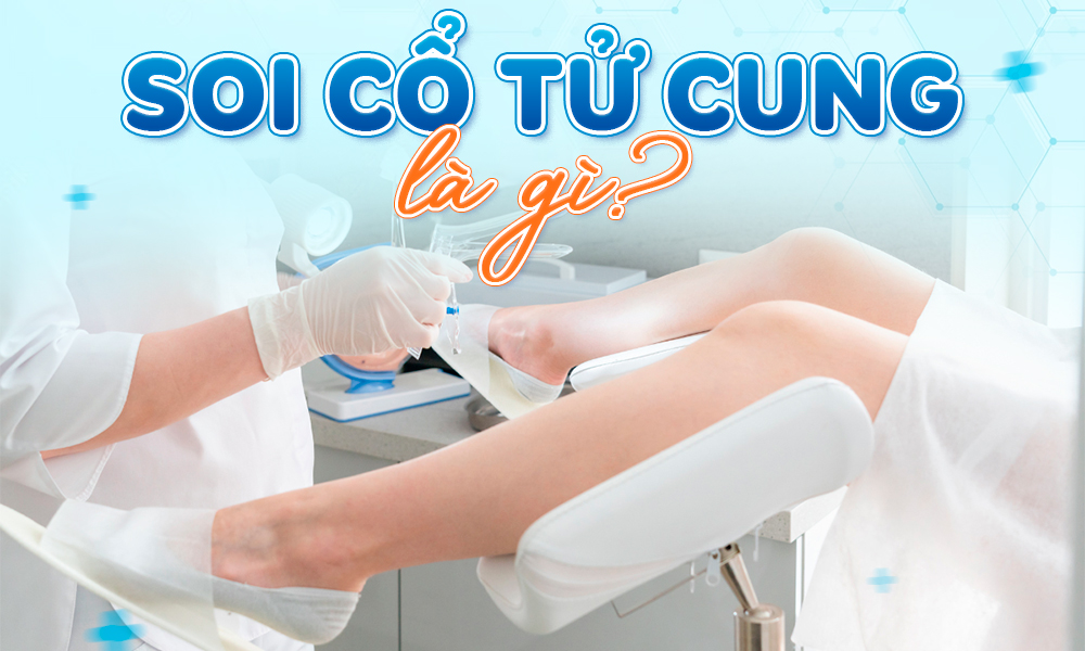 SOI CỔ TỬ CUNG