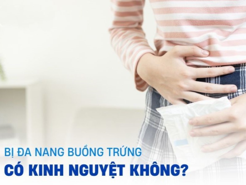 Đa nang buồng trứng có kinh nguyệt không?