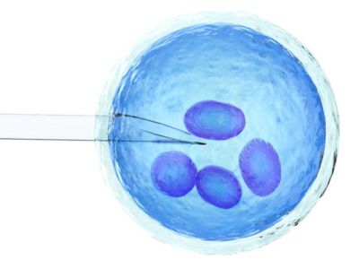 Chọc hút trứng là gì? Quy trình, lợi ích và lưu ý khi thực hiện