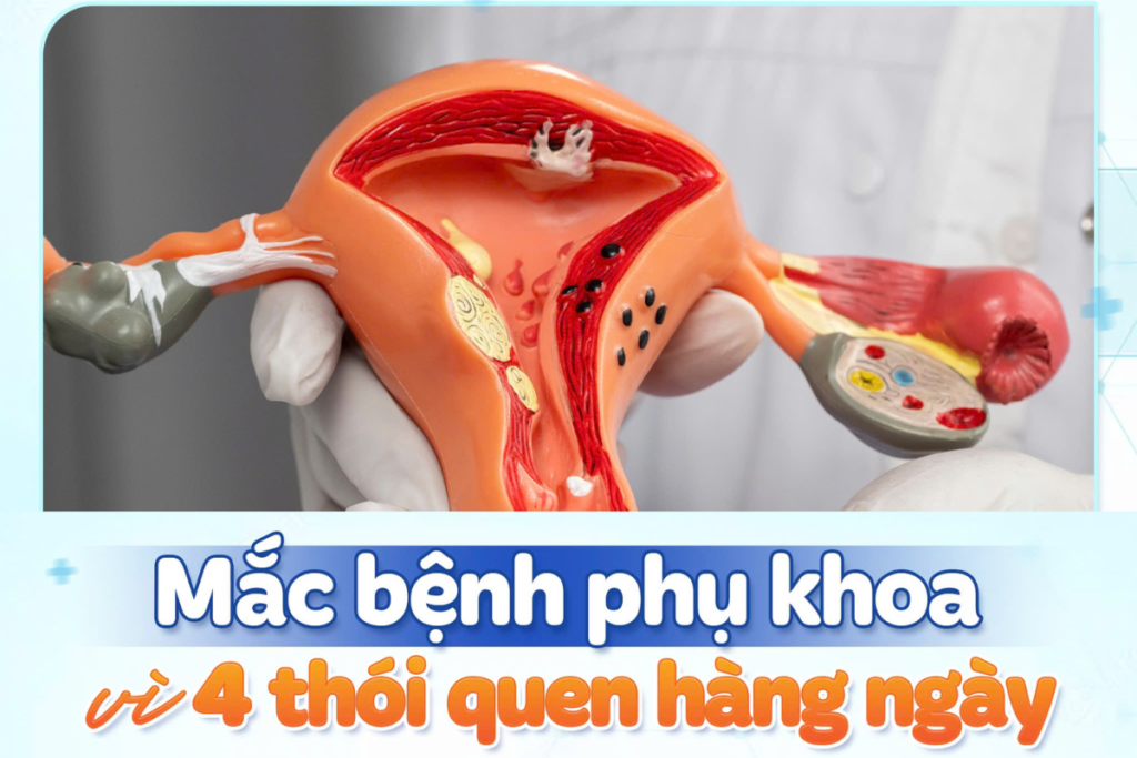 Bỏ ngay 4 thói quen này nếu không muốn bệnh phụ khoa “ghé thăm”