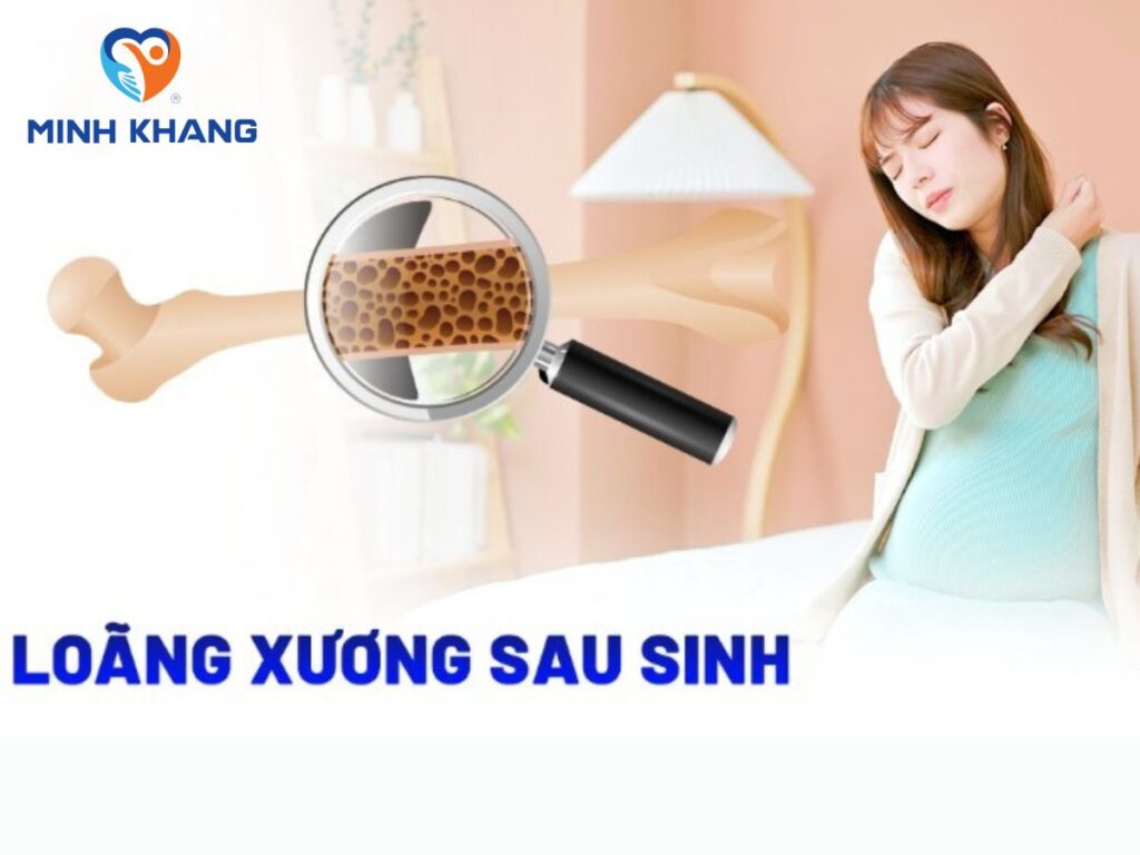 Nguyên nhân loãng xương sau sinh ở phụ nữ và cách phòng ngừa