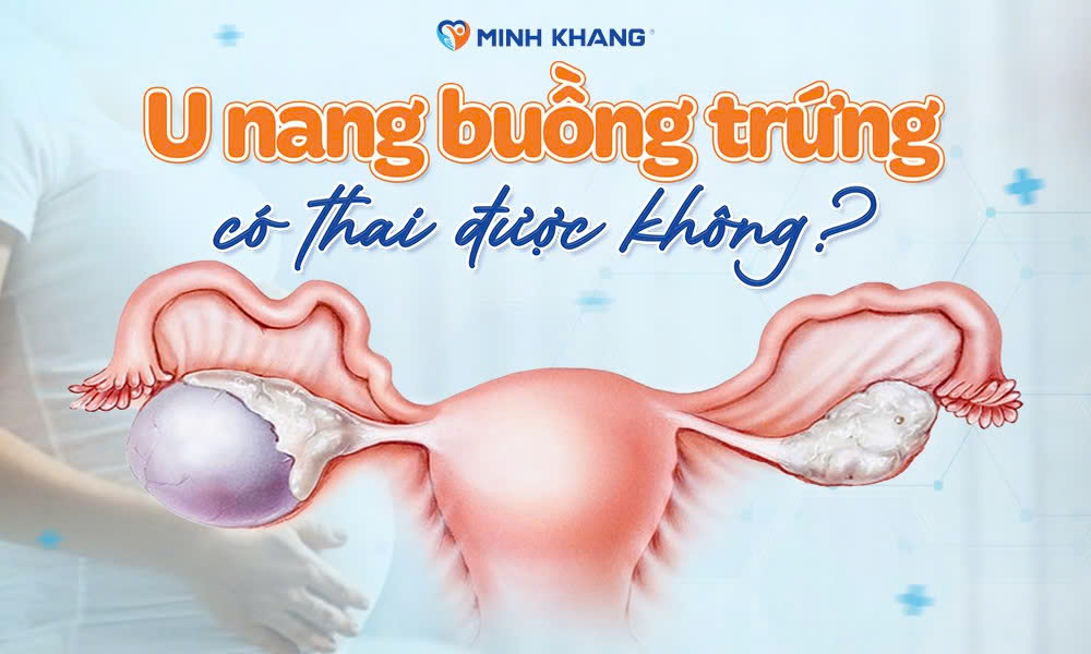 Bị u nang buồng trứng có thai được không? Cần lưu ý gì?