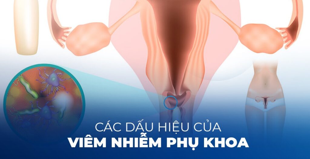 7 dấu hiệu của viêm nhiễm phụ khoa chị em chớ coi thường