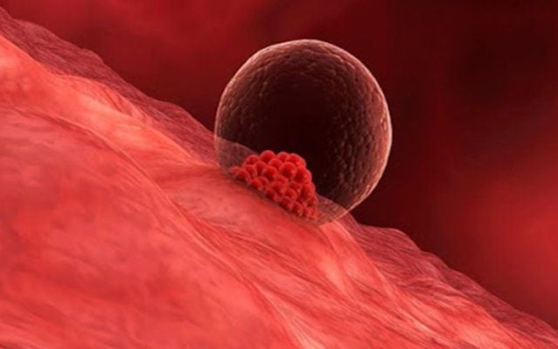 NHỮNG ĐIỀU CẦN LƯU Ý SAU CHUYỂN PHÔI ĐỂ TĂNG CƠ HÔI ĐẬU THAI 