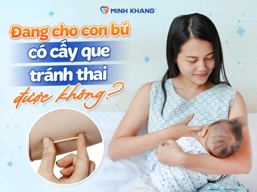 Đang cho con bú có cấy que tránh thai được không?