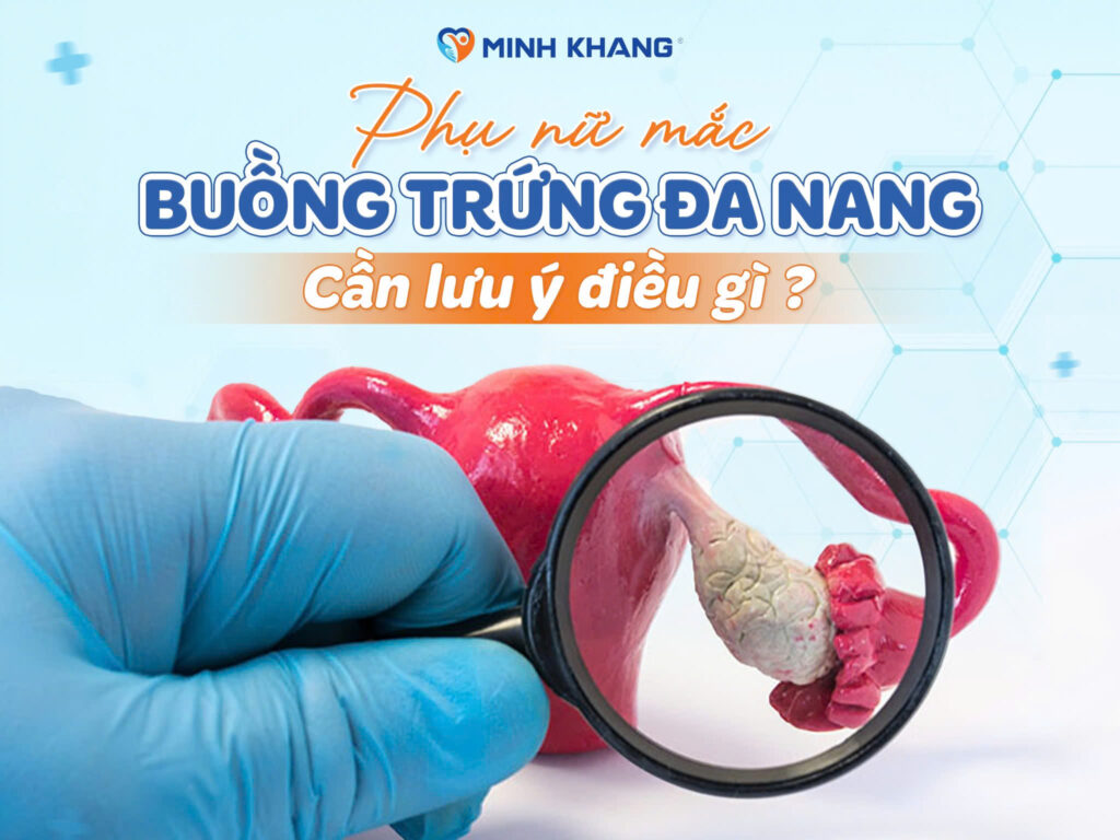 PHỤ NỮ MẮC HỘI CHỨNG BUỒNG TRỨNG ĐA NANG CẦN LƯU Ý GÌ?