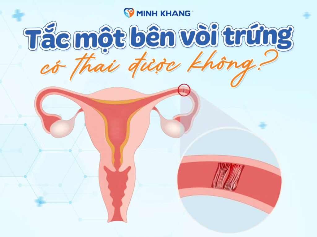 TẮC MỘT BÊN VÒI TRỨNG CÓ THAI ĐƯỢC KHÔNG?
