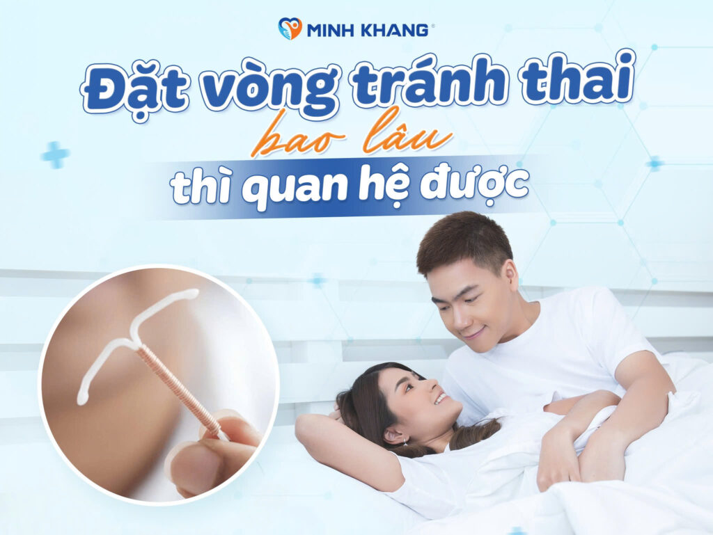Đặt vòng tránh thai bao lâu thì quan hệ được?